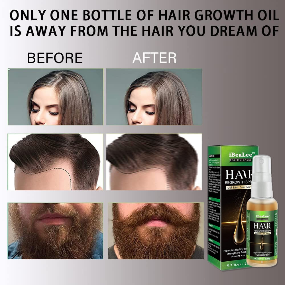 Spray Natural Mais Pelo